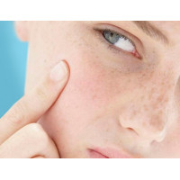 Как ухаживать за сухой кожей лица