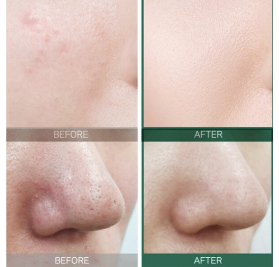 Восстанавливающий крем для проблемной кожи Some By Mi AHA-BHA-PHA 30 Days Miracle Cream 50 мл
